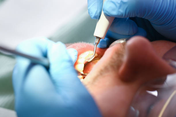 Best Walk-In Emergency Dentist in Vineyard, UT