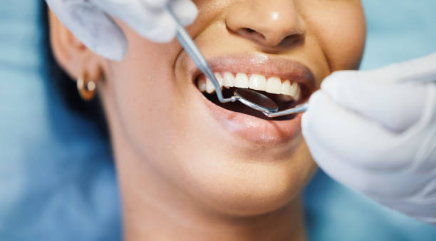 Best Weekend Emergency Dentist in Vineyard, UT